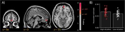 Dream Recall Frequency Is Associated With Medial Prefrontal Cortex White-Matter Density